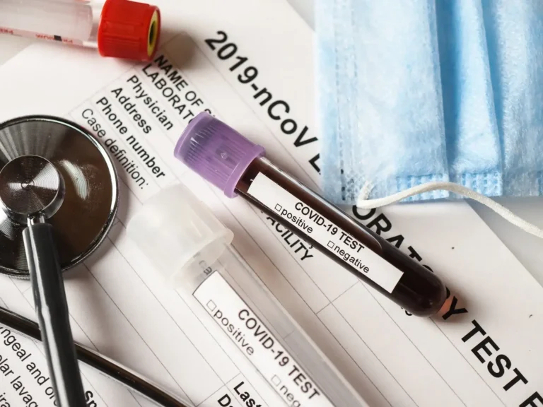 5 Mistakes to Avoid When Setting Up COVID-19 Testing